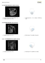 Предварительный просмотр 18 страницы Fona XPan 3D Plus Operating Instructions Manual