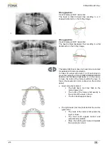 Предварительный просмотр 25 страницы Fona XPan 3D Plus Operating Instructions Manual