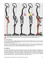 Предварительный просмотр 13 страницы Freedom KD2-00-KNEE2-KT Instructions For Use Manual