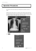 Preview for 4 page of FujiFilm CR Console Operation Manual