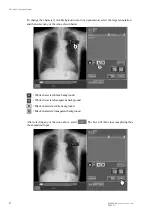 Preview for 8 page of FujiFilm CR Console Operation Manual