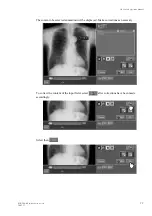 Preview for 11 page of FujiFilm CR Console Operation Manual