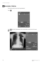 Preview for 12 page of FujiFilm CR Console Operation Manual