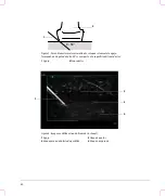 Preview for 36 page of FujiFilm SonoSite S Series User Manual Supplement