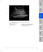 Preview for 37 page of FujiFilm SonoSite S Series User Manual Supplement