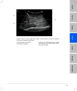 Предварительный просмотр 51 страницы FujiFilm SonoSite S Series User Manual Supplement