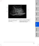 Предварительный просмотр 65 страницы FujiFilm SonoSite S Series User Manual Supplement