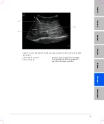 Предварительный просмотр 79 страницы FujiFilm SonoSite S Series User Manual Supplement