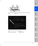 Предварительный просмотр 115 страницы FujiFilm SonoSite S Series User Manual Supplement