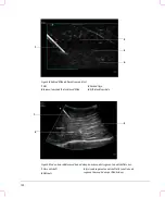 Предварительный просмотр 128 страницы FujiFilm SonoSite S Series User Manual Supplement