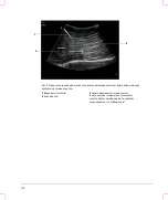 Preview for 156 page of FujiFilm SonoSite S Series User Manual Supplement