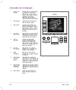 Preview for 206 page of FujiFilm SonoSite SII User Manual Supplement