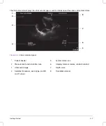 Preview for 17 page of FujiFilm SONOSITE X-PORTE User Manual