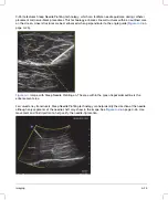 Preview for 101 page of FujiFilm SONOSITE X-PORTE User Manual