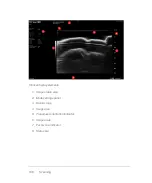 Preview for 198 page of FujiFilm VisualSonics Vevo MD User Manual