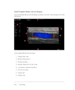 Preview for 250 page of FujiFilm VisualSonics Vevo MD User Manual