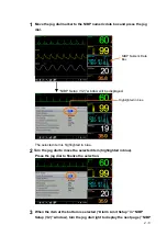 Preview for 55 page of Fukuda Denshi DSL-8001 Operation Manual