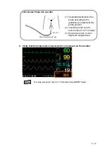 Preview for 111 page of Fukuda Denshi DSL-8001 Operation Manual