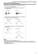 Preview for 113 page of Fukuda VaSera VS-2000 Series Operation Manual