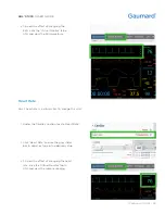 Предварительный просмотр 39 страницы Gaumard HAL S1030 User Manual