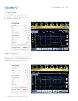 Предварительный просмотр 52 страницы Gaumard HAL S1030 User Manual