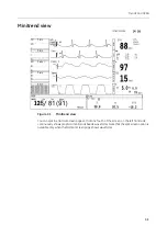 Предварительный просмотр 127 страницы GE HEALTHCARE B20 User'S Reference Manual