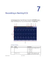 Preview for 69 page of GE HEALTHCARE MAC 2000 Operator'S Manual