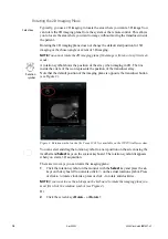 Предварительный просмотр 10 страницы GE BK MEDICAL 8838 Series User Manual