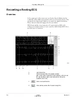 Предварительный просмотр 78 страницы GE CASE V6.7 Operator'S Manual