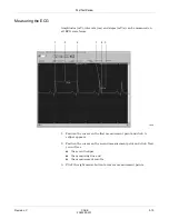 Предварительный просмотр 87 страницы GE CASE V6.7 Operator'S Manual