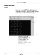 Предварительный просмотр 151 страницы GE CASE V6.7 Operator'S Manual