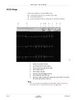 Предварительный просмотр 152 страницы GE CASE V6.7 Operator'S Manual