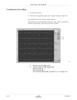 Предварительный просмотр 158 страницы GE CASE V6.7 Operator'S Manual