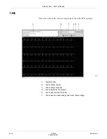 Предварительный просмотр 162 страницы GE CASE V6.7 Operator'S Manual