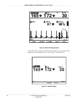 Предварительный просмотр 44 страницы GE Corometrics 126 Service Manual