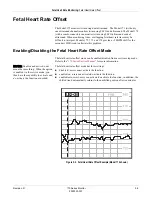 Preview for 63 page of GE Corometrics 170 Series Operator'S Manual