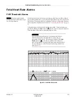 Preview for 67 page of GE Corometrics 170 Series Operator'S Manual