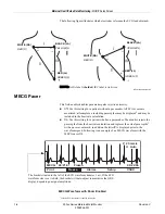 Предварительный просмотр 88 страницы GE Corometrics 250cx Series Operator'S Manual