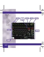 Preview for 3 page of GE DASH 3000 V5 Quick Reference Manual