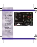 Preview for 8 page of GE DASH 3000 V5 Quick Reference Manual