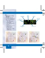 Preview for 15 page of GE DASH 3000 V5 Quick Reference Manual