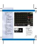 Preview for 20 page of GE DASH 3000 V5 Quick Reference Manual