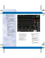 Preview for 22 page of GE DASH 3000 V5 Quick Reference Manual