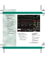 Preview for 26 page of GE DASH 3000 V5 Quick Reference Manual