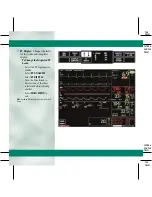 Preview for 29 page of GE DASH 3000 V5 Quick Reference Manual