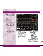 Preview for 34 page of GE DASH 3000 V5 Quick Reference Manual