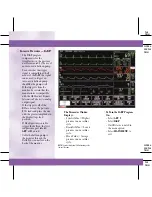 Preview for 48 page of GE DASH 3000 V5 Quick Reference Manual