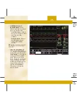 Preview for 56 page of GE DASH 3000 V5 Quick Reference Manual