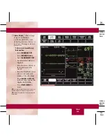 Preview for 61 page of GE DASH 3000 V5 Quick Reference Manual