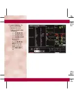 Preview for 66 page of GE DASH 3000 V5 Quick Reference Manual